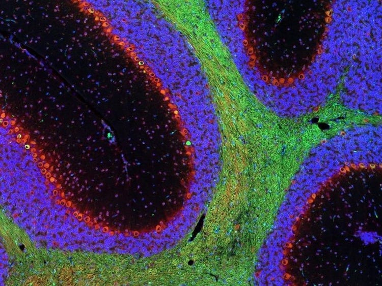 Fluorescence imaging of a mouse brain