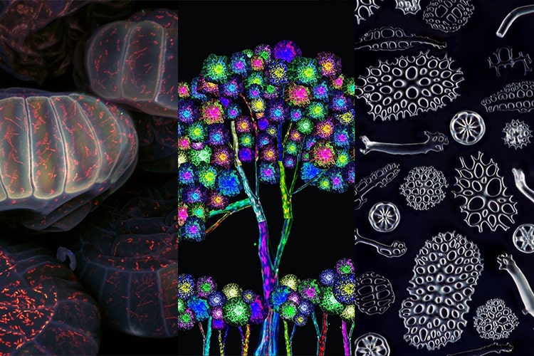 2020年7月受欢迎的显微影像