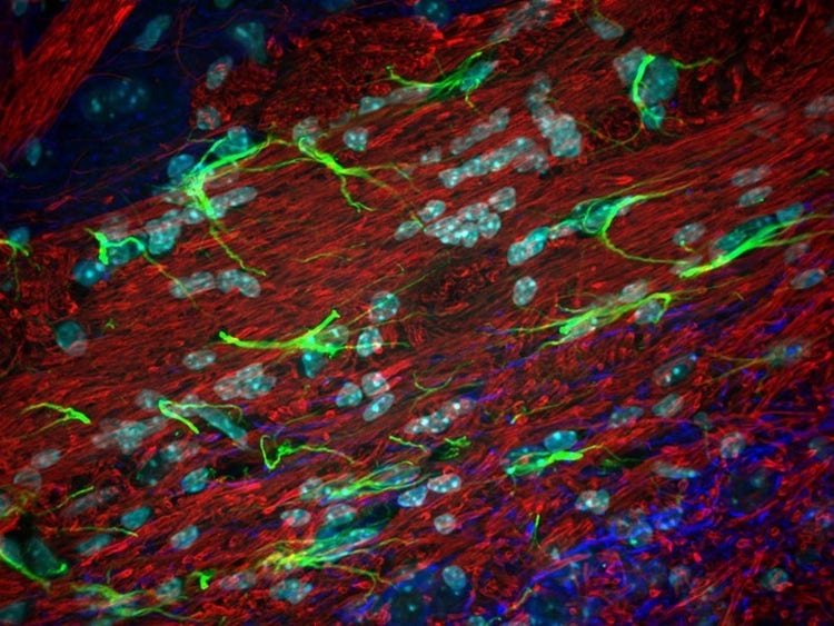 Picture, Picture, Picture