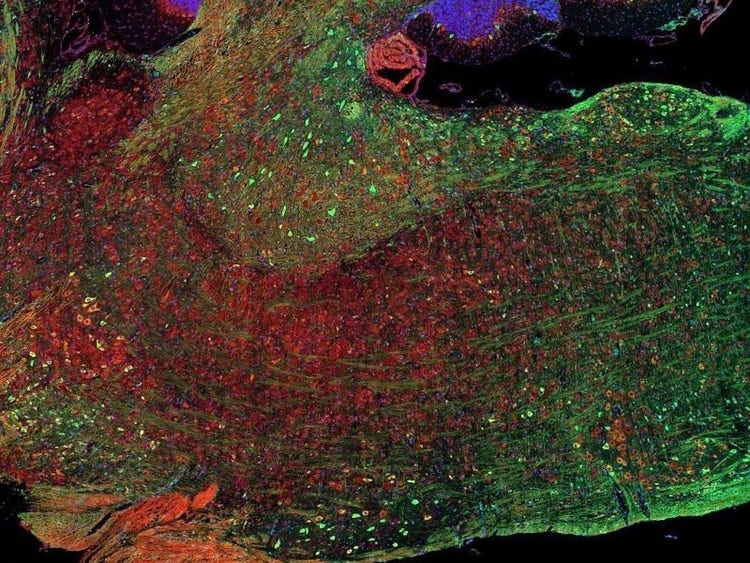 Fluorescence imaging of a mouse brain