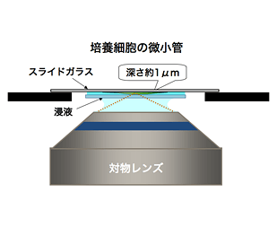 図2 培養細胞の微小管（ほとんど表面付近［表面から約1μｍ］）