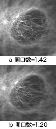 図2 培養細胞の微小管（ほとんど表面付近［表面から約1μｍ］）