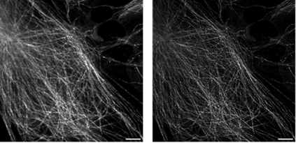 How the TruSight™ SR Algorithm Achieves Super-Resolution Imaging in Confocal Spinning Disk Microscopy