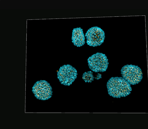 3D epithelial breast cancer spheroids. DAPI (blue), pericentrin (yellow).