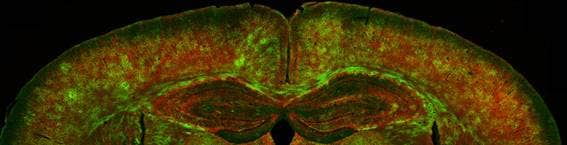 Spinning Disk Confocal Microscopy Advances Brain Myelin Research for Alzheimer's Disease