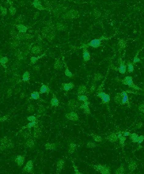 Calcium imaging: chemical indicator Fluo-3 in neuronal cells.