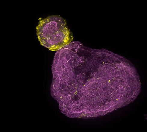 Organoid. Phalloidin (magenta), E-cadherin (yellow).
