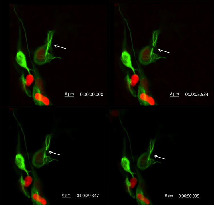 Time-lapse sequence in a living zebrafish embryo.