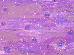 Aluminum alloy - Polarized light observation