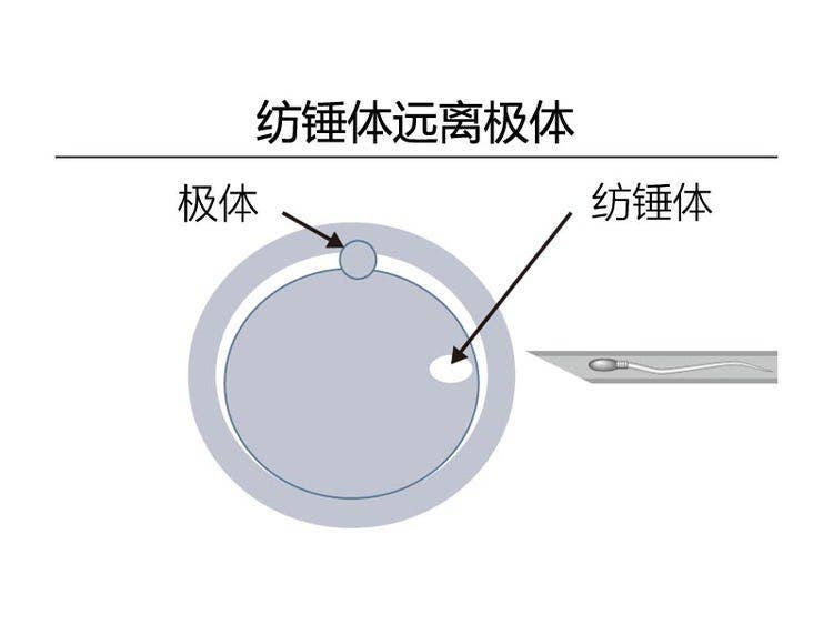 纺锤体远离极体