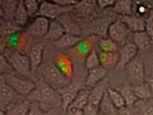 Luciferase, GFP and brightfield