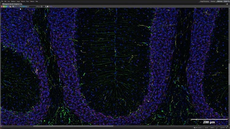 深层样品的清晰图像