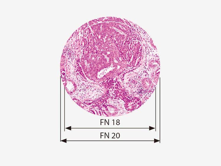 视场数（FN）为20