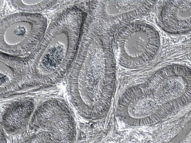 Intestine thin section